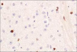 Immunohistochemistry: PIF1 Antibody [NBP1-97931] - IHC analysis of PIF1 in mouse brain using DAB with hematoxylin counterstain.