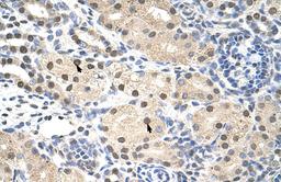 Antibody used in IHC on Human kidney.