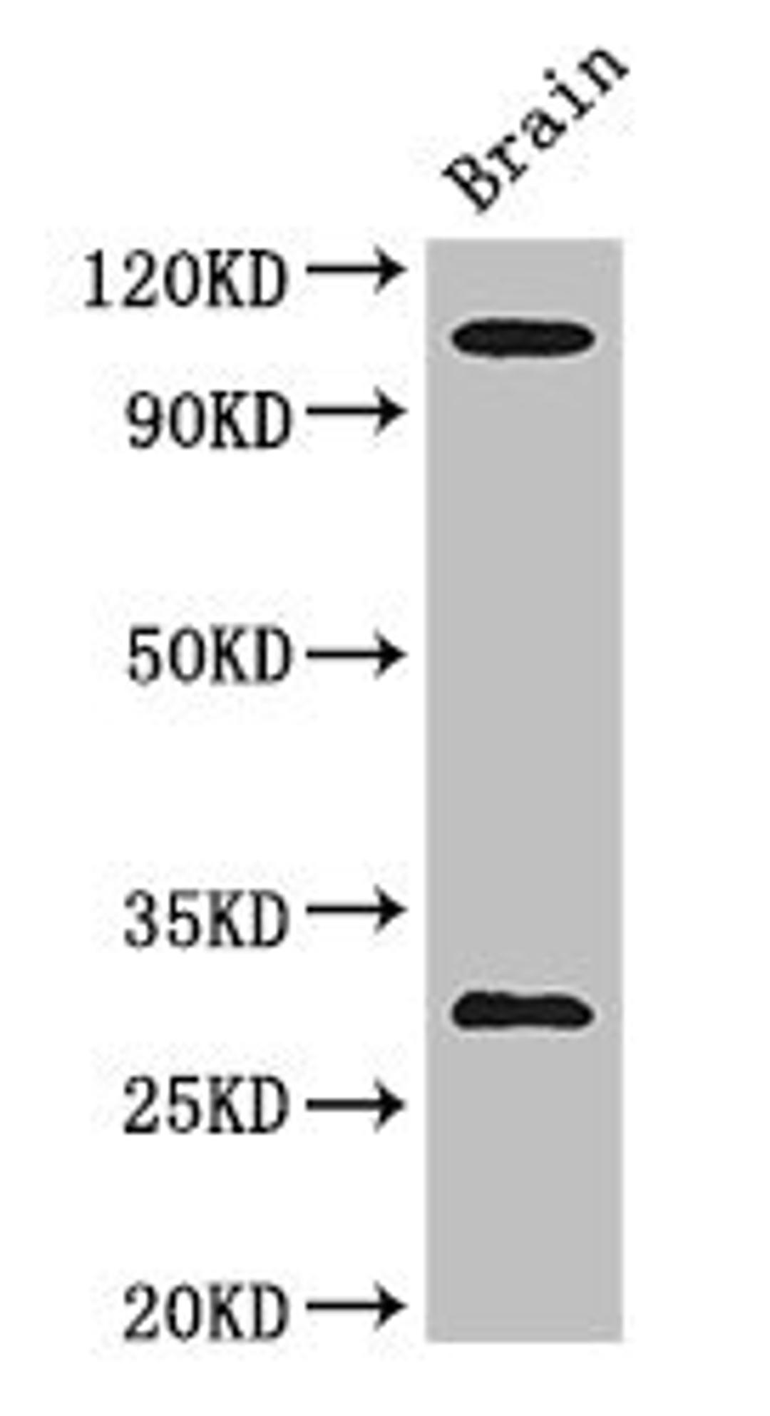 Western Blot. Positive WB detected in: Mouse brain tissue. All lanes: EPHA1 antibody at 3ug/ml. Secondary. Goat polyclonal to rabbit IgG at 1/50000 dilution. Predicted band size: 109, 53, 52 kDa. Observed band size: 109, 30 kDa. 