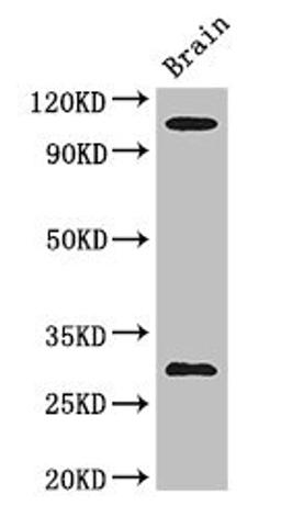 Western Blot. Positive WB detected in: Mouse brain tissue. All lanes: EPHA1 antibody at 3ug/ml. Secondary. Goat polyclonal to rabbit IgG at 1/50000 dilution. Predicted band size: 109, 53, 52 kDa. Observed band size: 109, 30 kDa. 