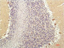 Immunohistochemical analysis of paraffin-embedded Human Brain Tissue using SGK1 Mouse mAb diluted at 1:200.