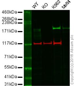 Western blot - Anti-BRG1 antibody [EPNCIR111A] (ab110641)