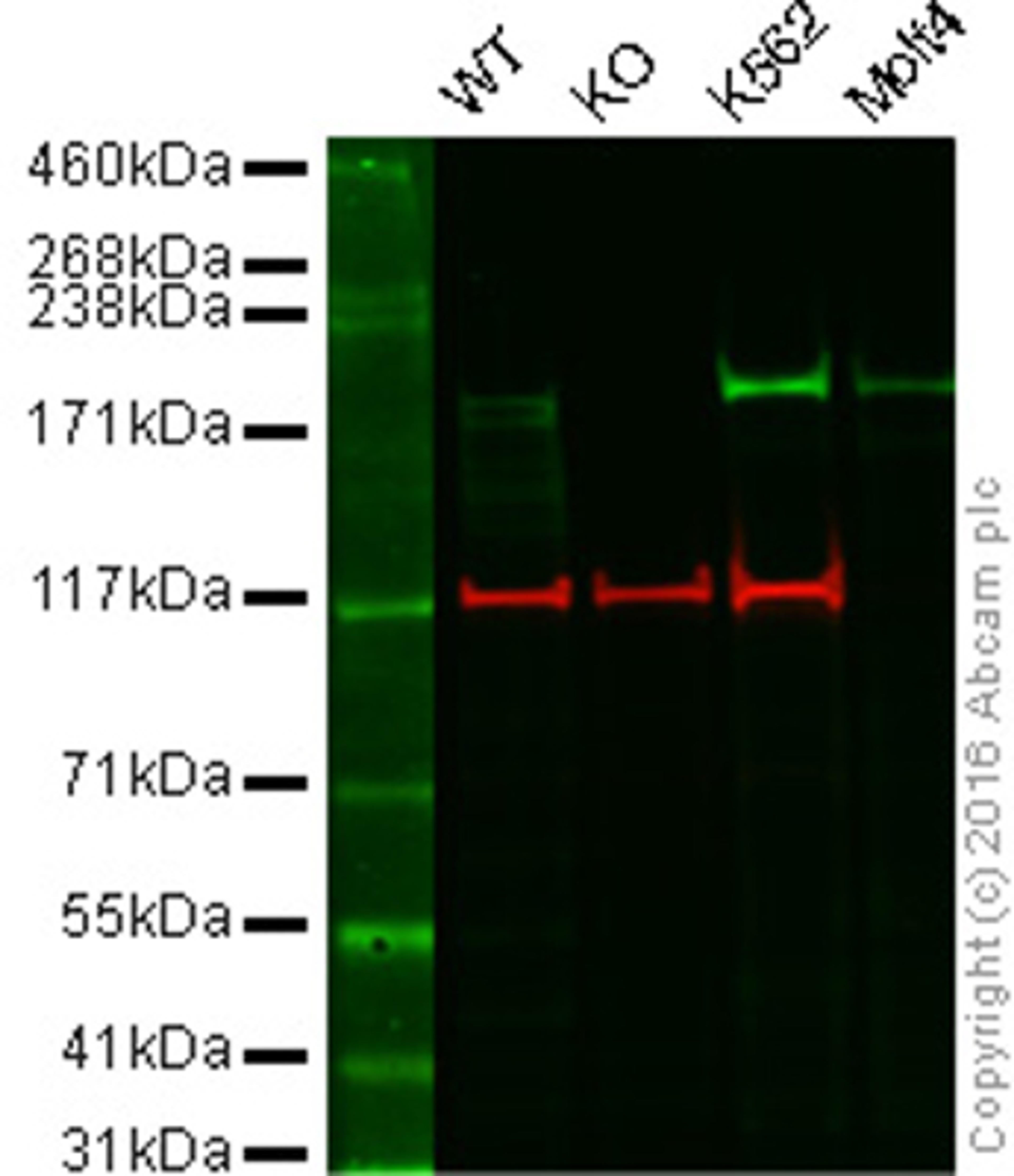 Western blot - Anti-BRG1 antibody [EPNCIR111A] (ab110641)