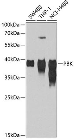 Western blot - PBK antibody (A4852)