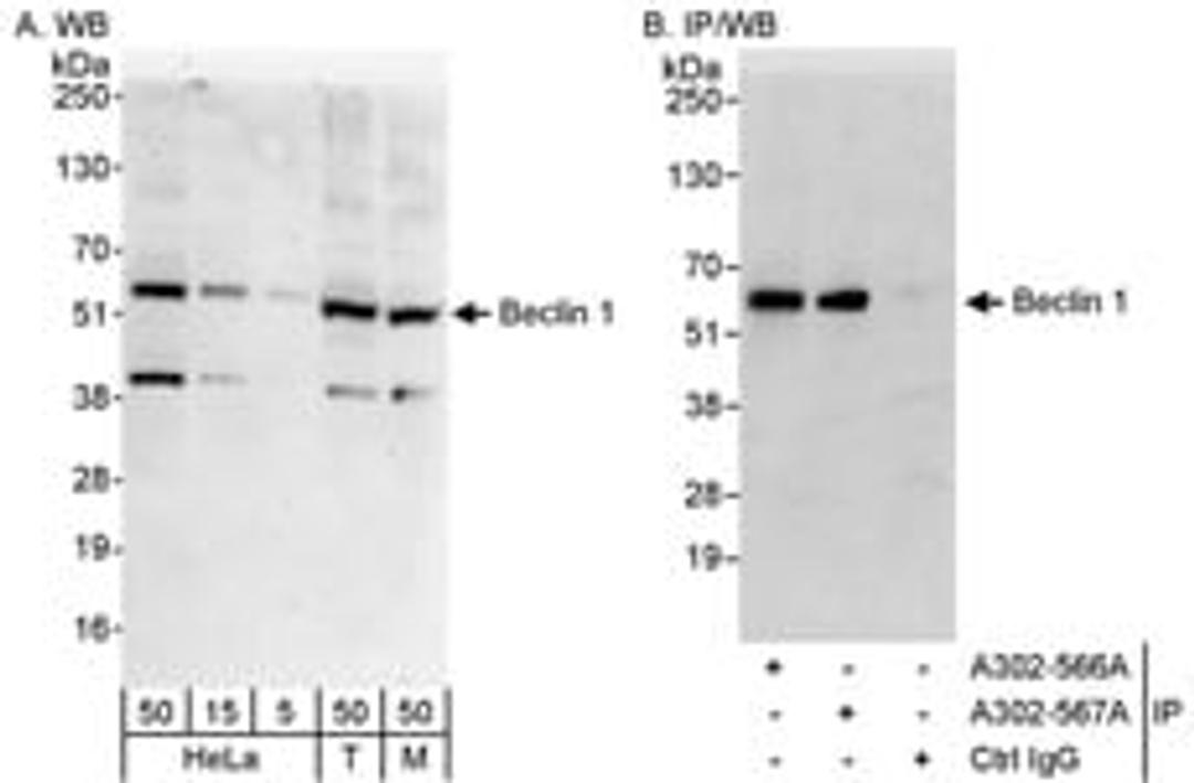 Detection of human and mouse Beclin 1 by western blot (h&m) and immunoprecipitation (h).