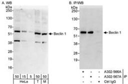 Detection of human and mouse Beclin 1 by western blot (h&m) and immunoprecipitation (h).