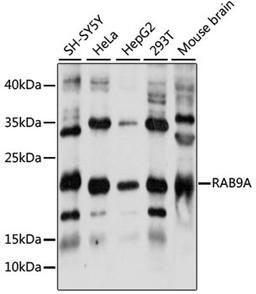 Western blot - RAB9A antibody (A7041)