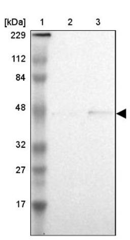 Western Blot: ASB10 Antibody [NBP1-86145] - Lane 1: Marker [kDa] 229, 112, 84, 48, 32, 27, 17<br/>Lane 2: Human cell line RT-4<br/>Lane 3: Human cell line U-251MG sp