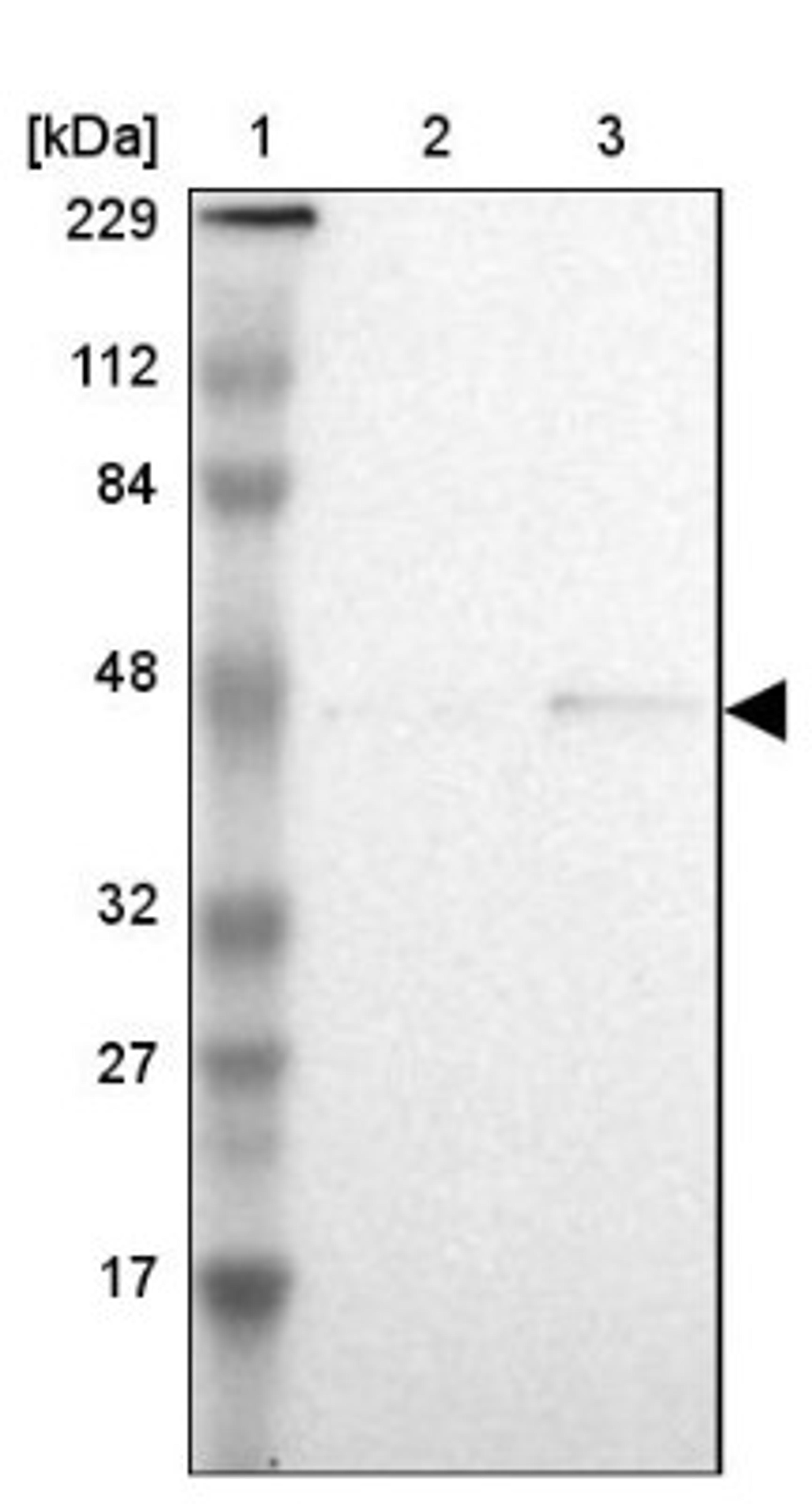 Western Blot: ASB10 Antibody [NBP1-86145] - Lane 1: Marker [kDa] 229, 112, 84, 48, 32, 27, 17<br/>Lane 2: Human cell line RT-4<br/>Lane 3: Human cell line U-251MG sp