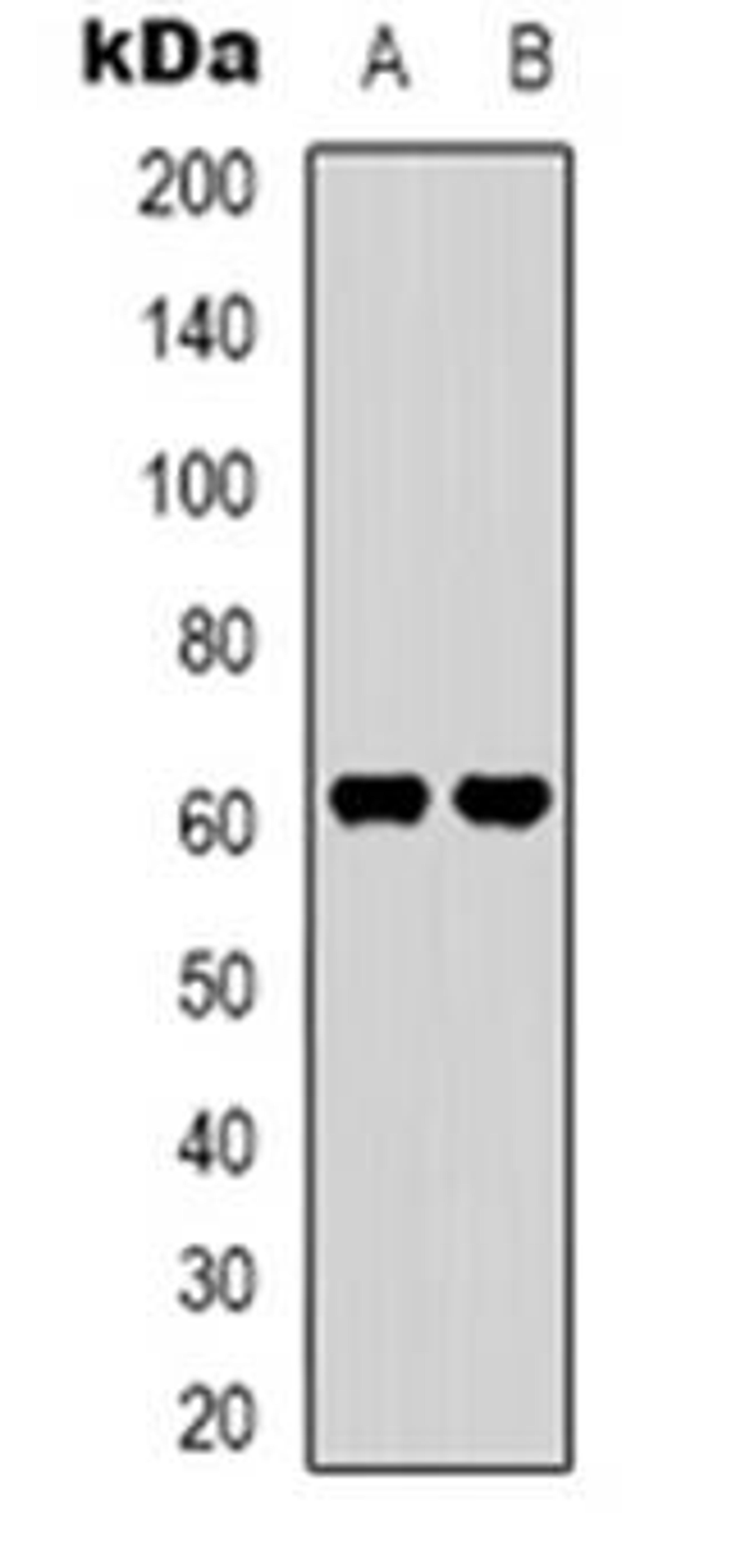 Western blot analysis of SVOP expression in HepG2 (Lane 1), K562 (Lane 2) whole cell lysates using SVOP antibody