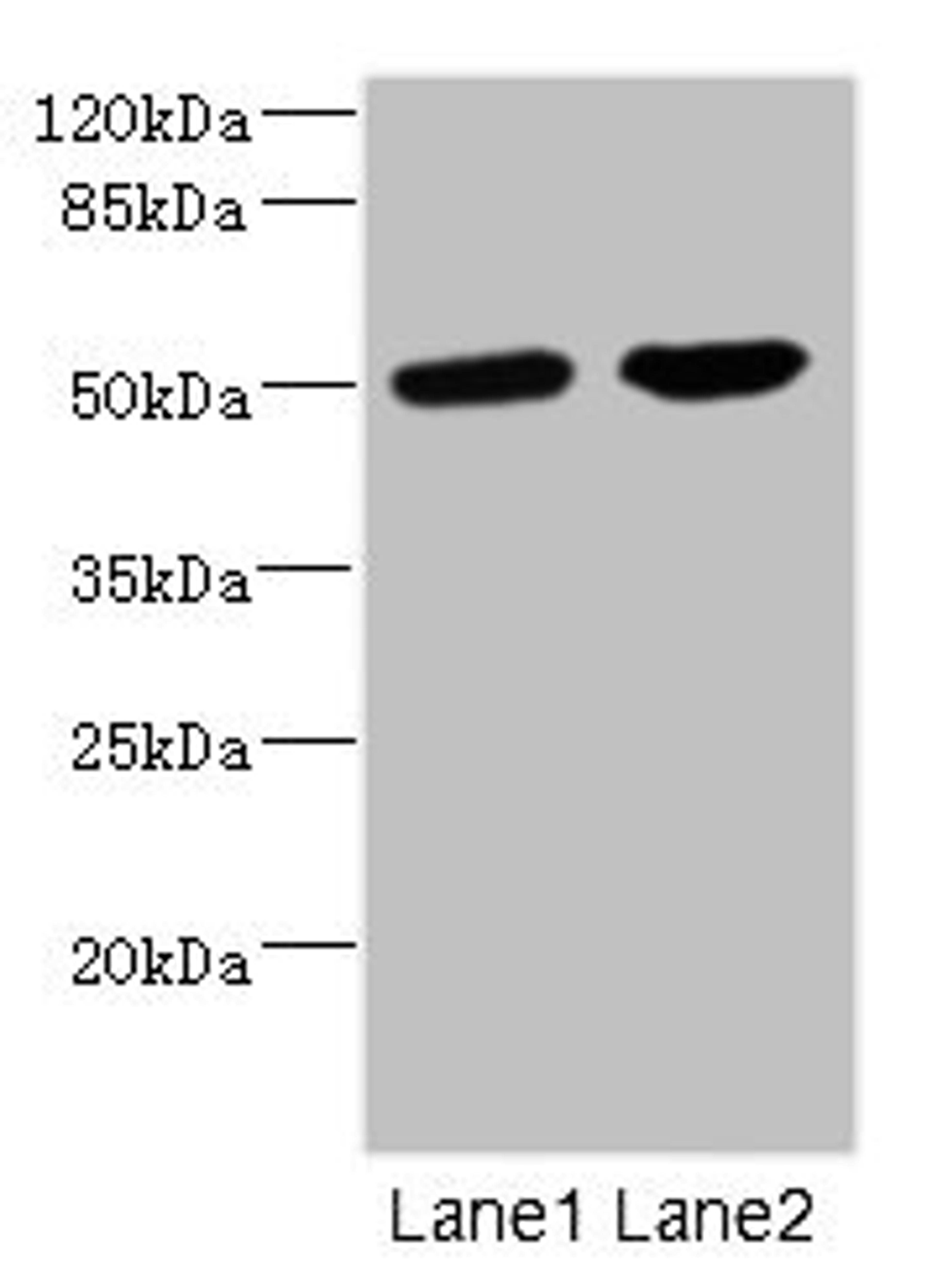 Western blot. All lanes: CHRNA10 antibody at 0.57µg/ml. Lane 1: Jurkat whole cell lysate. Lane 2: A549 whole cell lysate. Secondary. Goat polyclonal to rabbit IgG at 1/10000 dilution. Predicted band size: 50 kDa. Observed band size: 50 kDa