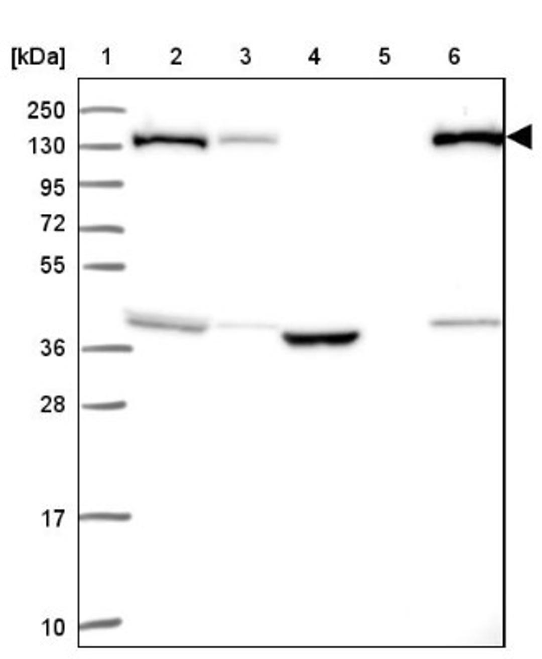 Western Blot: SUPT16H Antibody [NBP2-38607] - Lane 1: Marker [kDa] 250, 130, 95, 72, 55, 36, 28, 17, 10<br/>Lane 2: RT-4<br/>Lane 3: U-251 MG<br/>Lane 4: Human Plasma<br/>Lane 5: Liver<br/>Lane 6: Tonsil