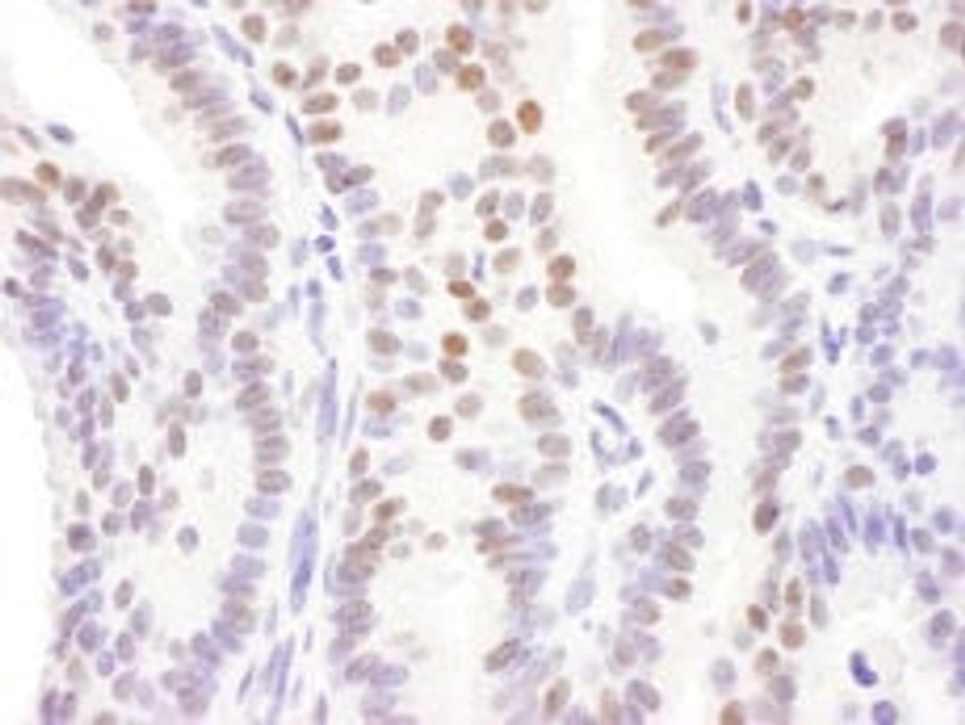 Detection of human DACH1 by immunohistochemistry.