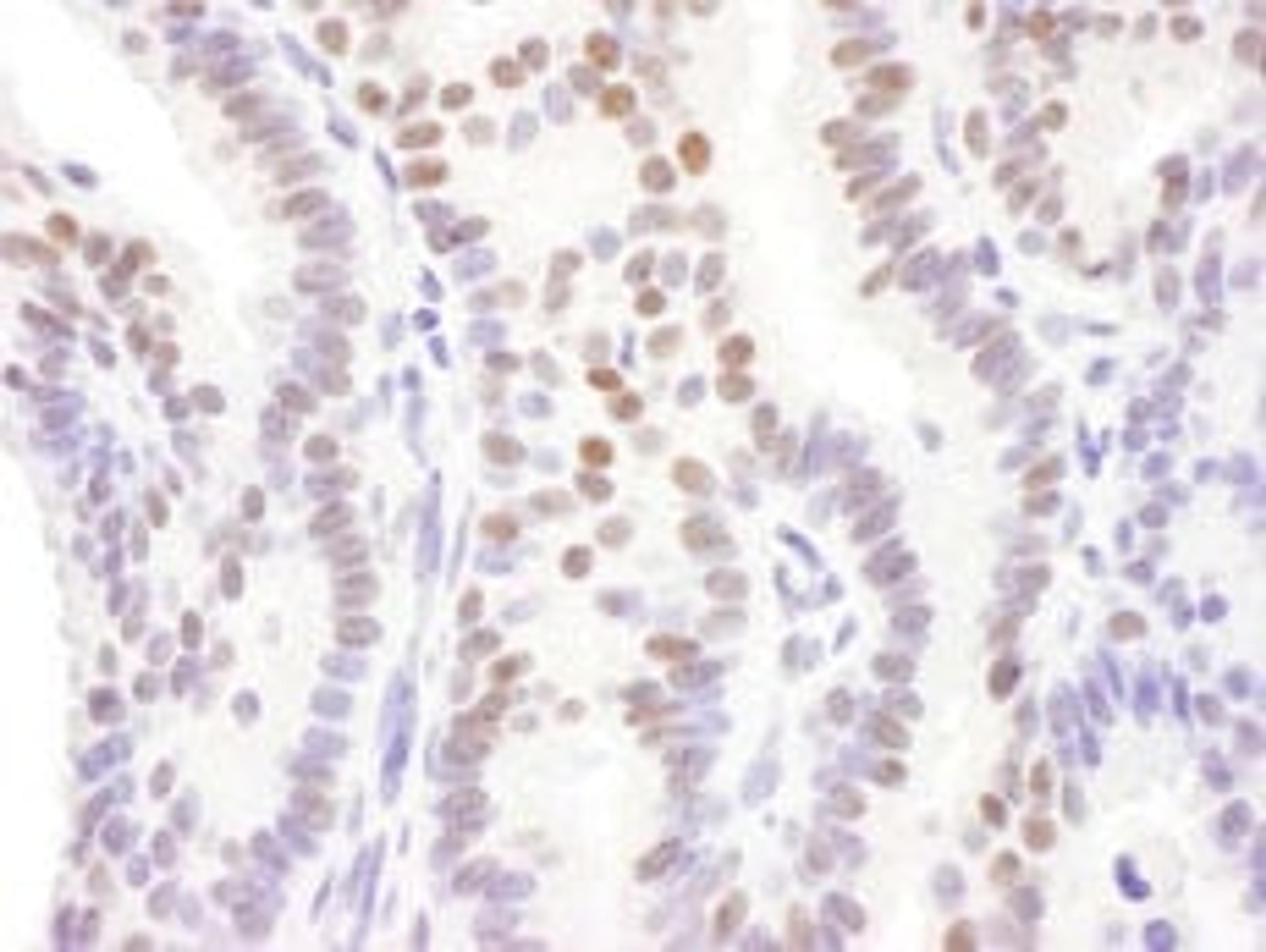 Detection of human DACH1 by immunohistochemistry.