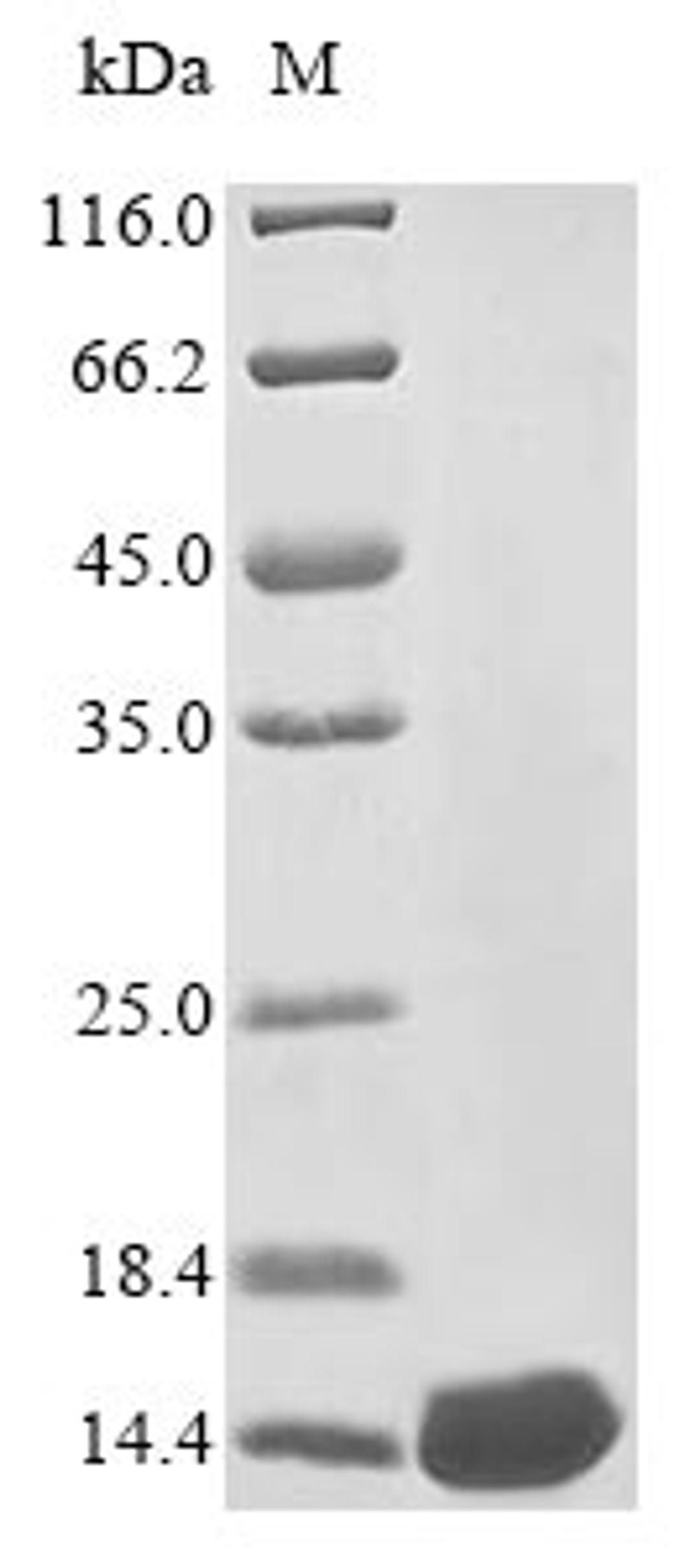 (Tris-Glycine gel) Discontinuous SDS-PAGE (reduced) with 5% enrichment gel and 15% separation gel.