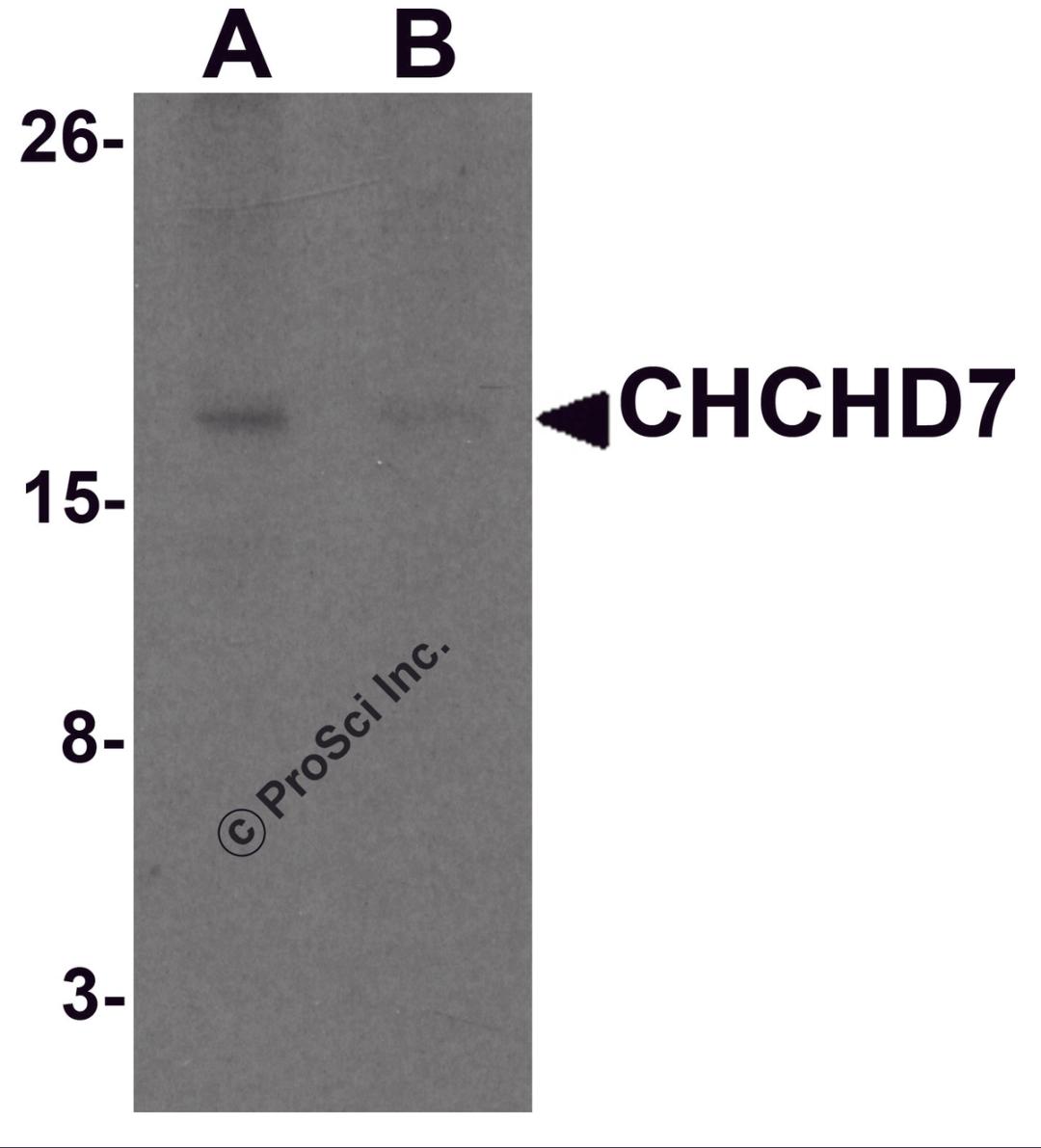 Western blot analysis of CHCHD7 in rat liver tissue lysate with CHCHD7 antibody at 1 μg/mL in (A) the absence and (B) the presence of blocking peptide.