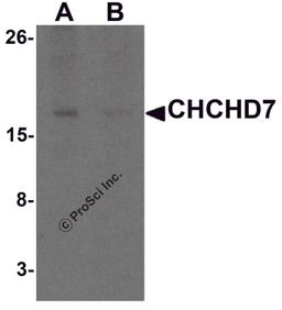 Western blot analysis of CHCHD7 in rat liver tissue lysate with CHCHD7 antibody at 1 μg/mL in (A) the absence and (B) the presence of blocking peptide.