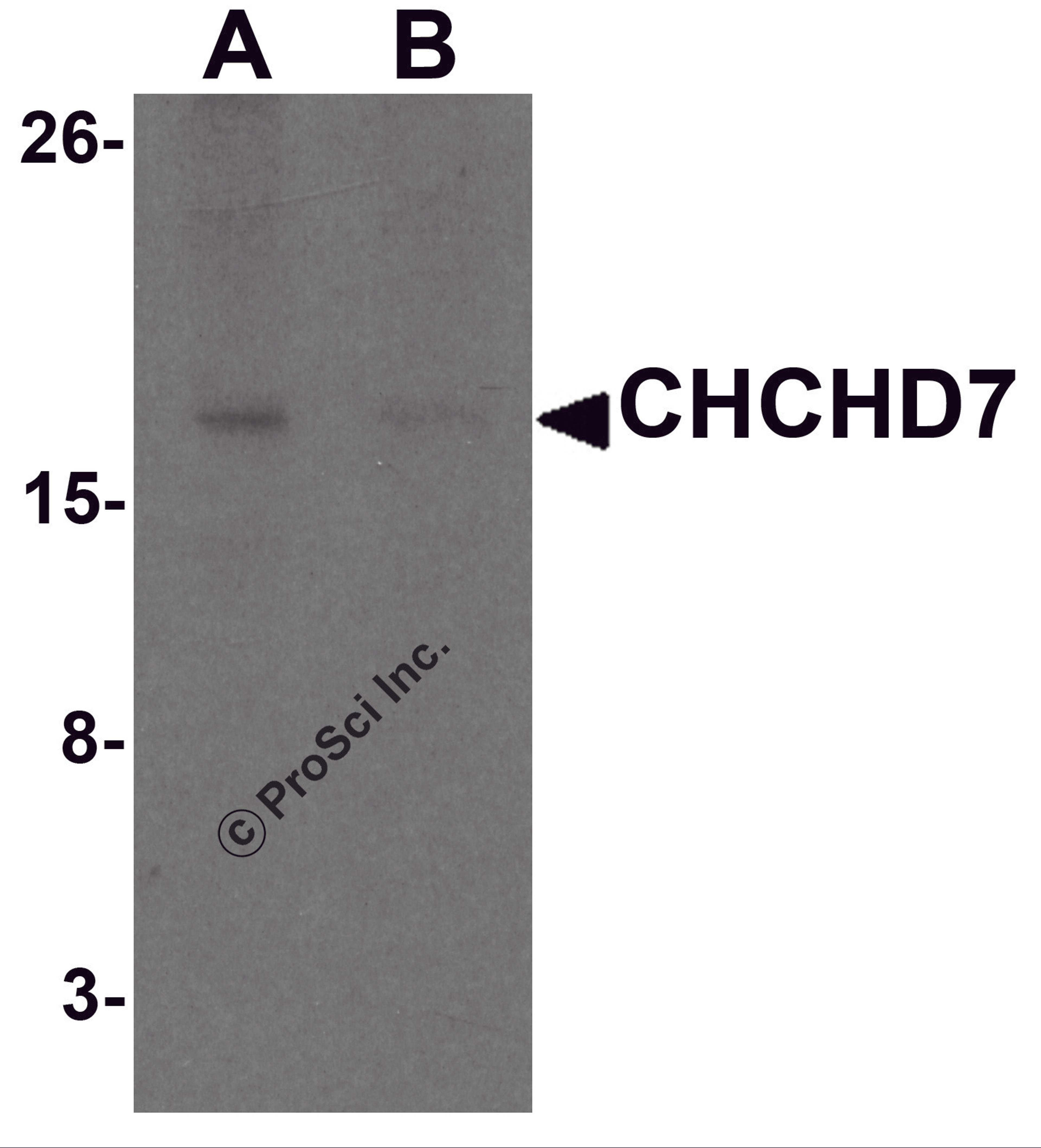 Western blot analysis of CHCHD7 in rat liver tissue lysate with CHCHD7 antibody at 1 μg/mL in (A) the absence and (B) the presence of blocking peptide.