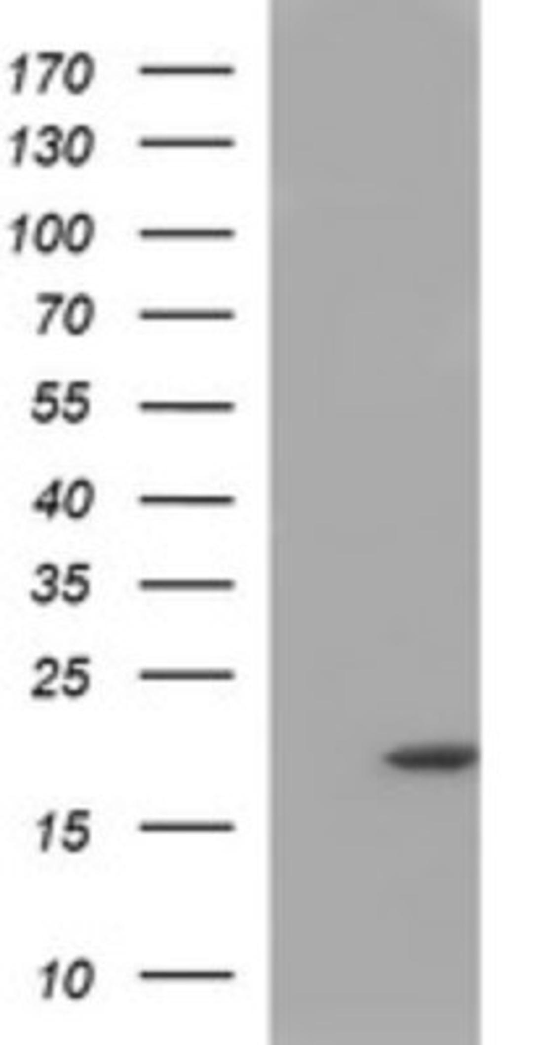 Western Blot: PLA2G16/HRASLS3 Antibody (1A5) [NBP2-46429] - Analysis of HEK293T cells were transfected with the pCMV6-ENTRY control (Left lane) or pCMV6-ENTRY PLA2G16.