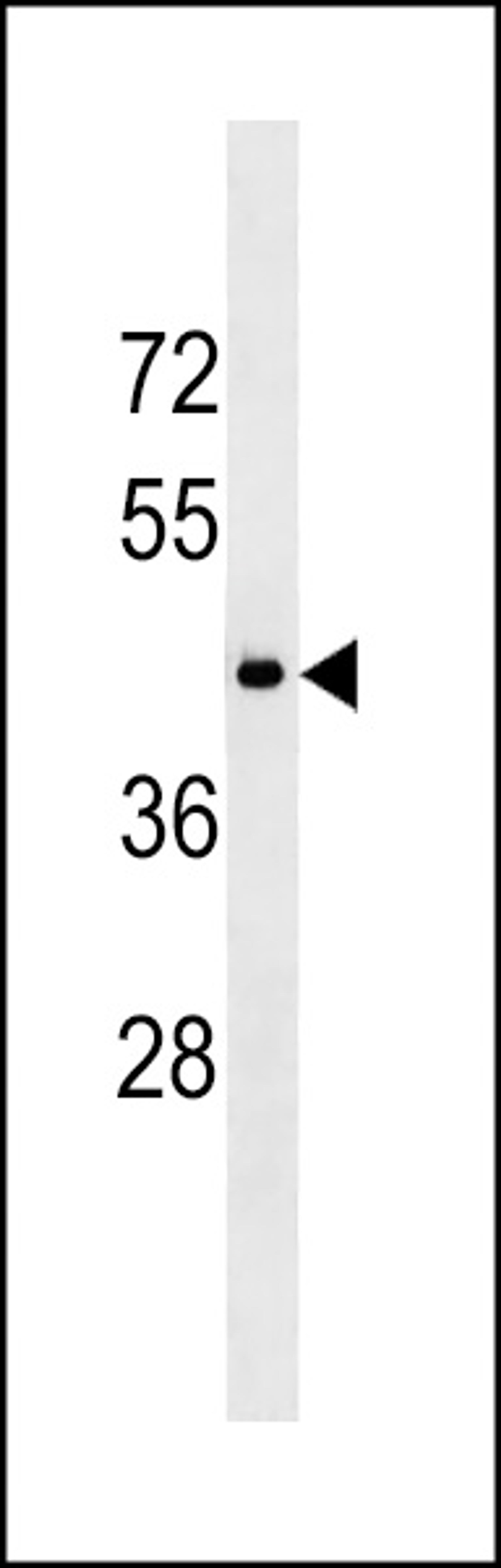 Western blot analysis in mouse stomach tissue lysates (35ug/lane).