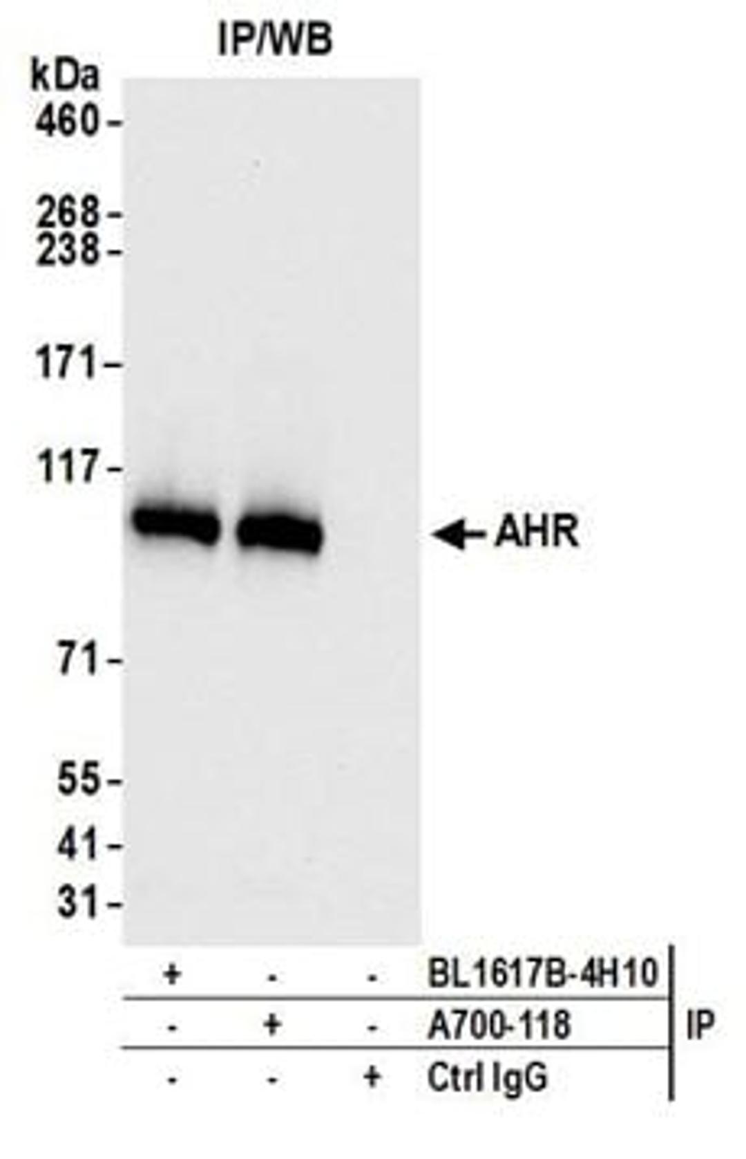 Detection of human AHR by western blot of immunoprecipitates.