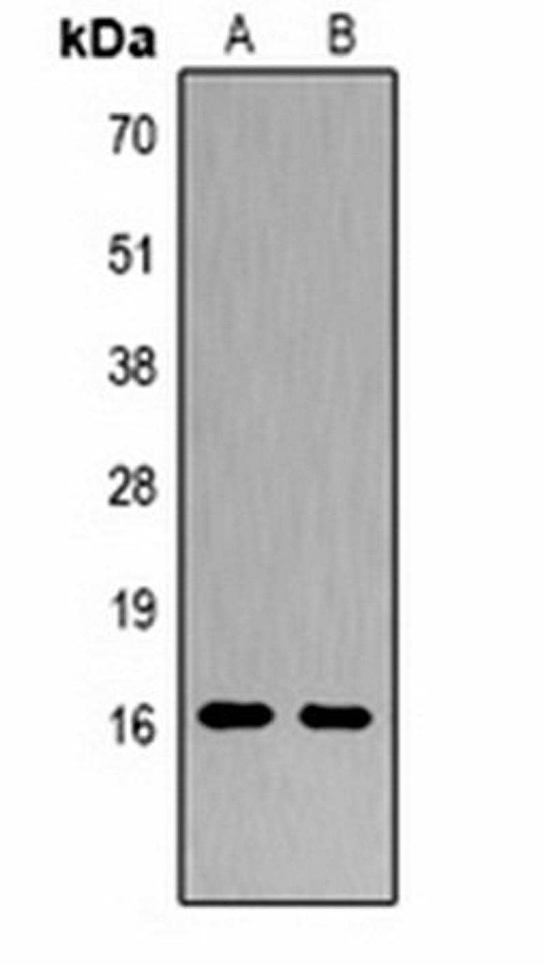 Western blot analysis of  Hela (Lane1), NIH3T3 (Lane2) whole cell lysates using Histone H3 (Citruline R2+R8+R17) antibody