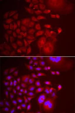 Immunofluorescence analysis of U2OS cell using TRAPPC10 antibody