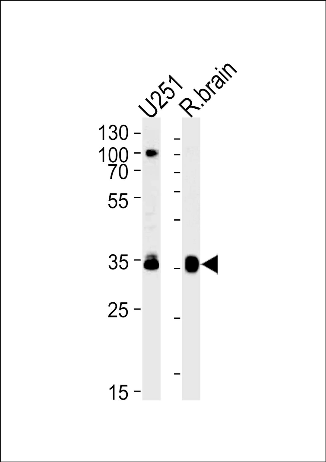 Western blot analysis in U251 cell line and rat brain lysates (35ug/lane).