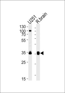 Western blot analysis in U251 cell line and rat brain lysates (35ug/lane).