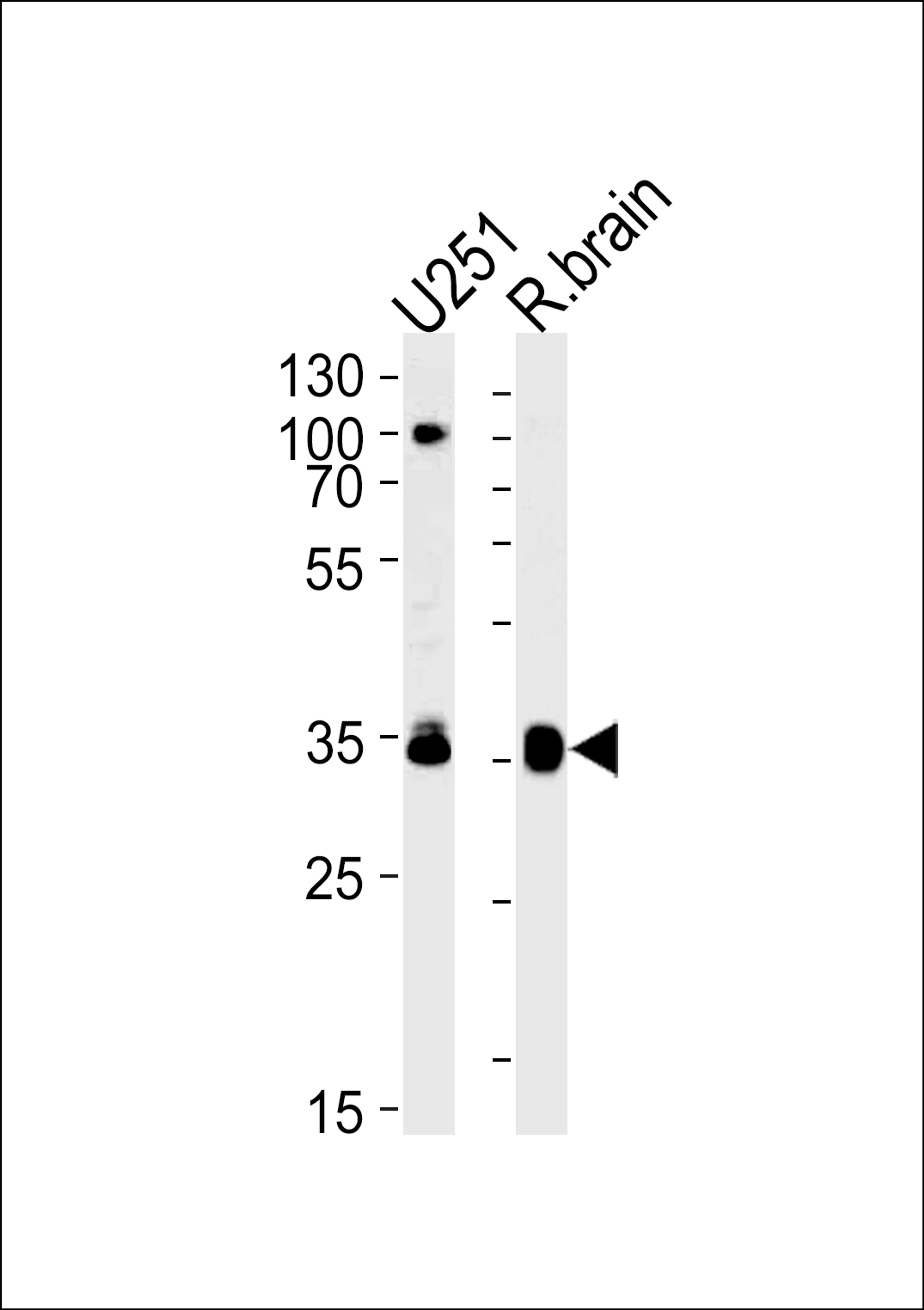 Western blot analysis in U251 cell line and rat brain lysates (35ug/lane).