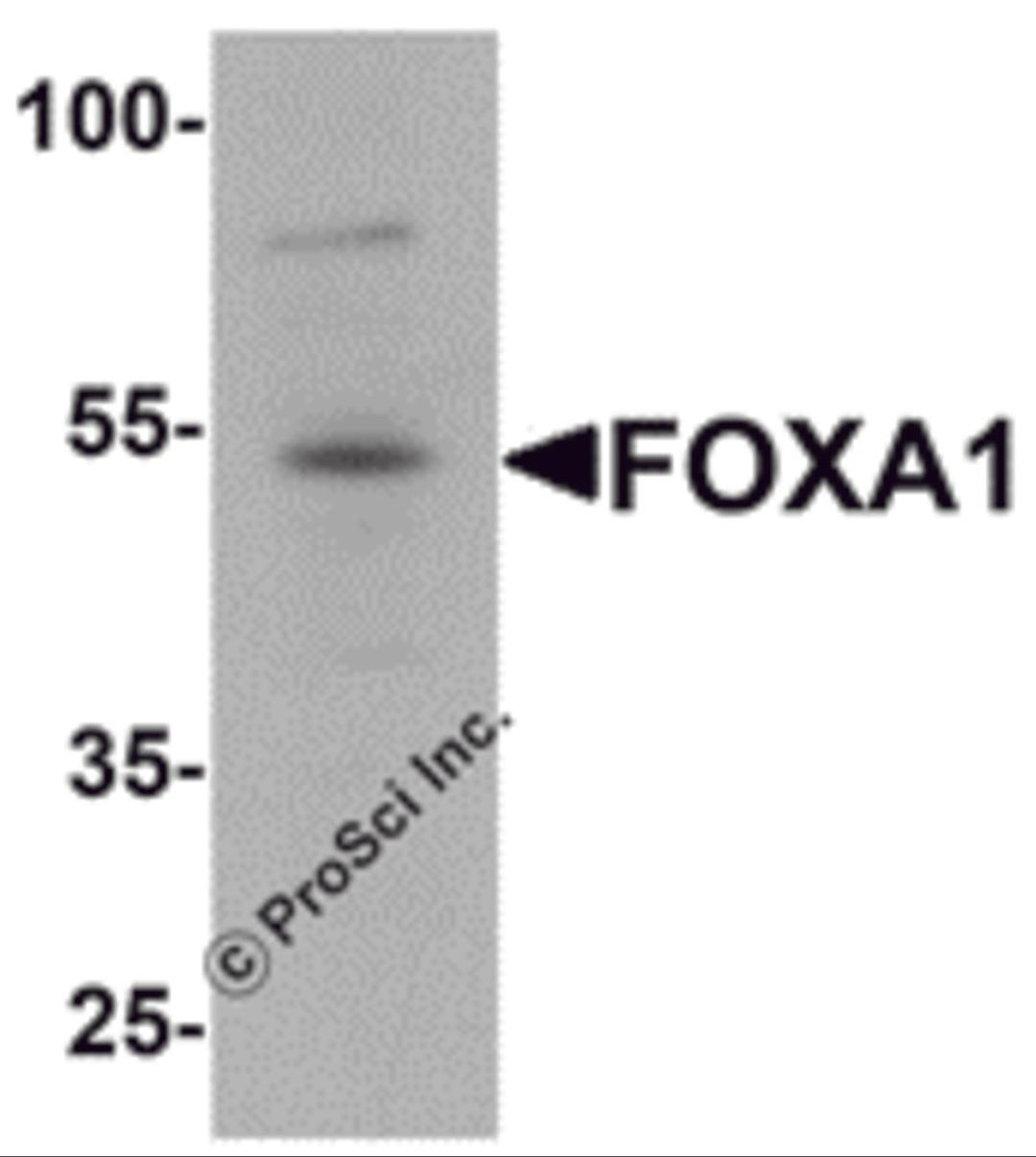 Western blot analysis of FOXA1 in 293 cell lysate with FOXA1 antibody at 1 &#956;g/mL