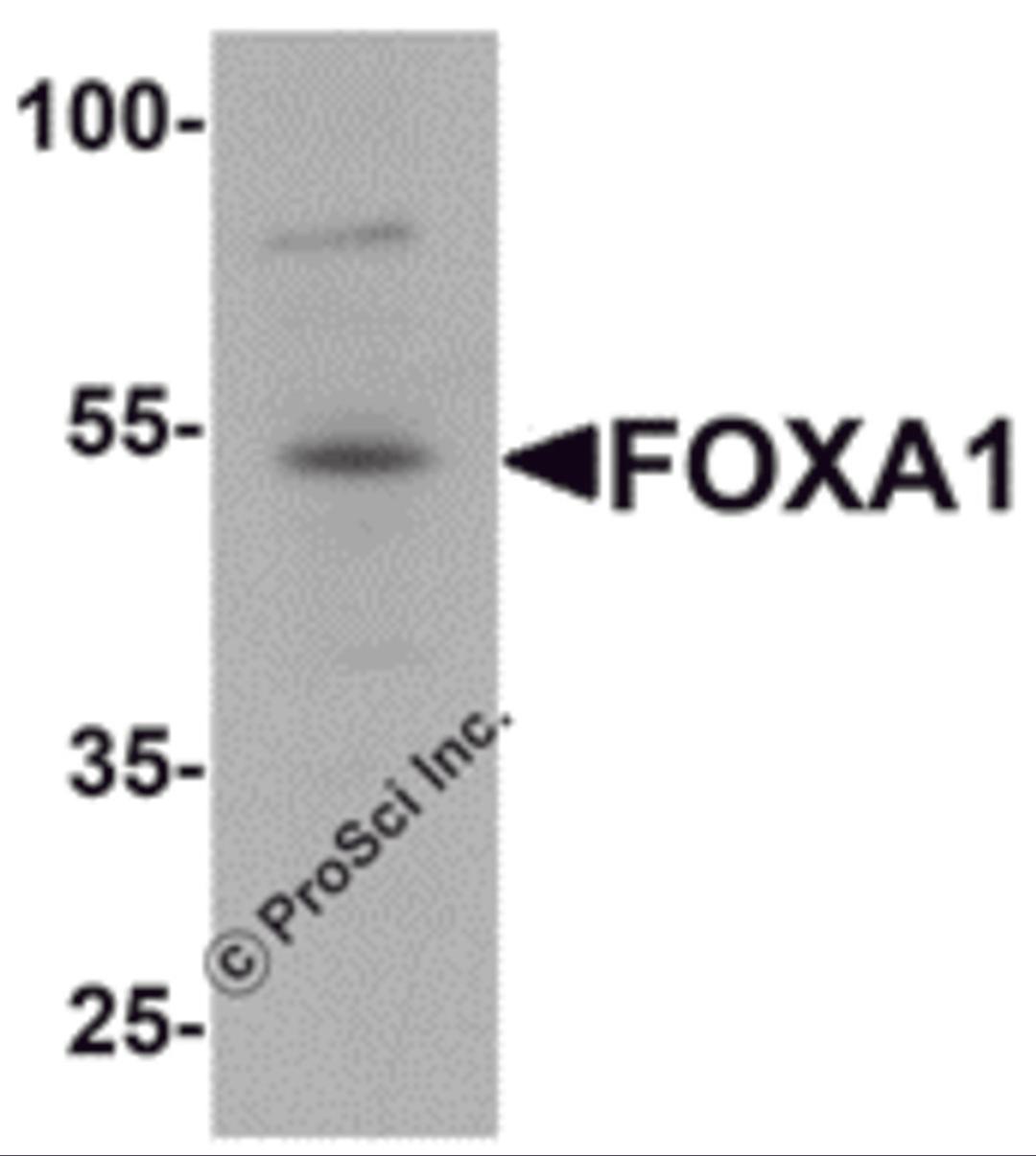 Western blot analysis of FOXA1 in 293 cell lysate with FOXA1 antibody at 1 μg/mL