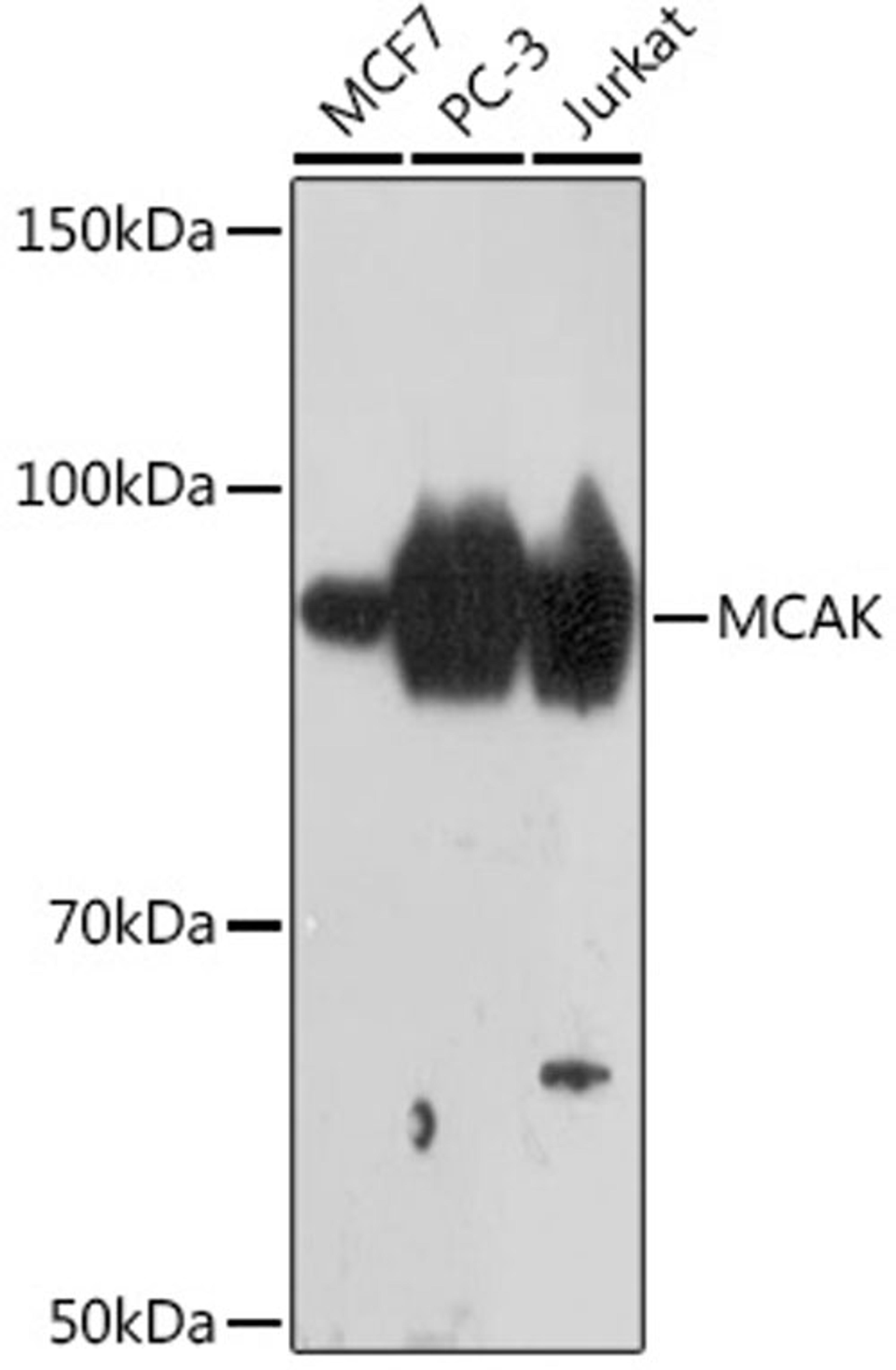 Western blot - MCAK Rabbit mAb (A9140)