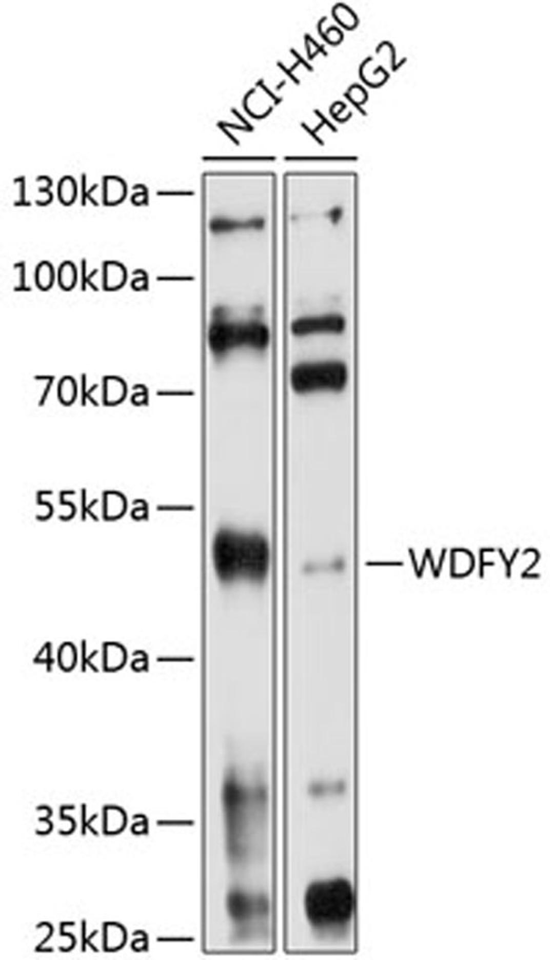 Western blot - WDFY2 antibody (A10598)