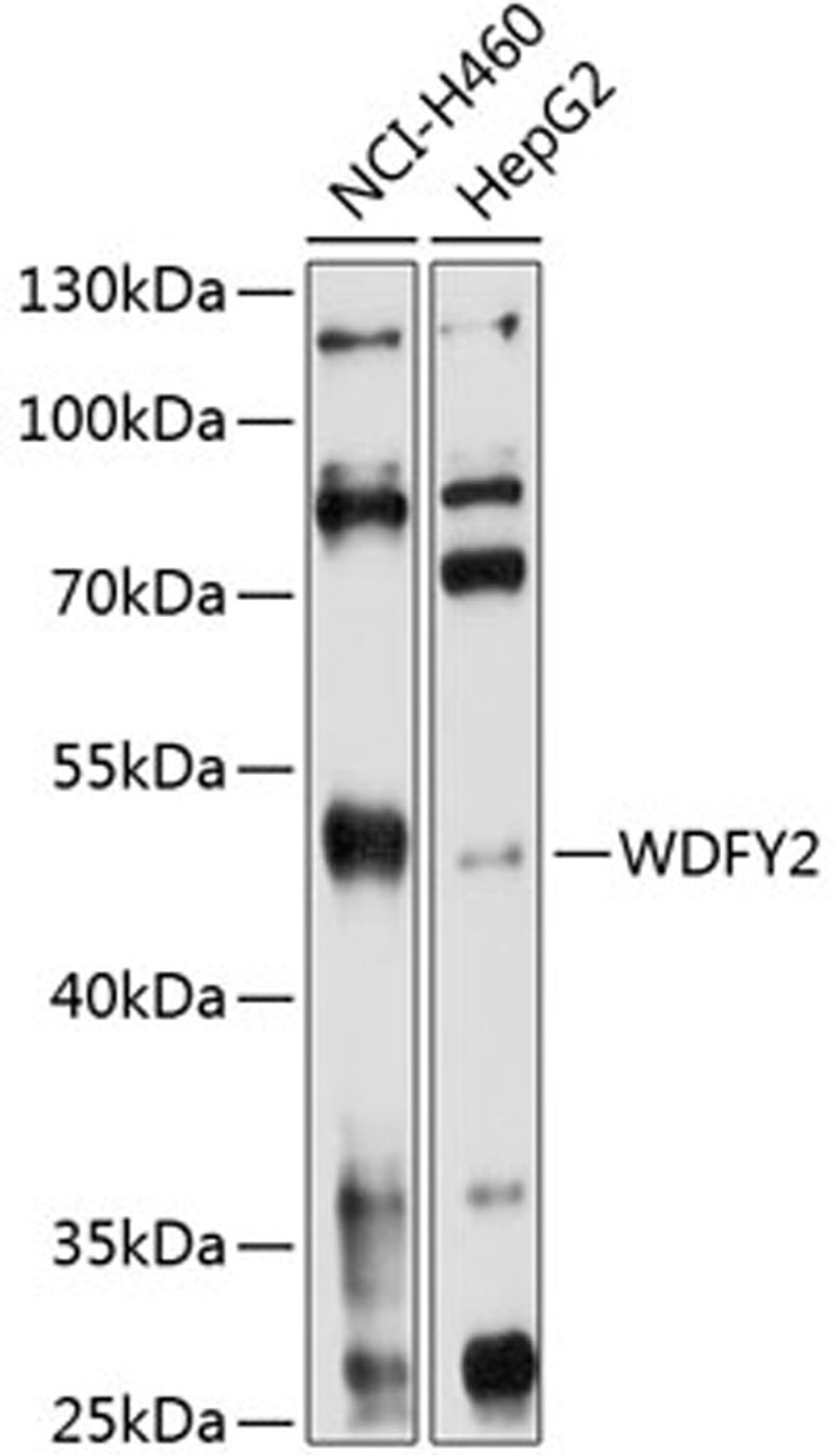 Western blot - WDFY2 antibody (A10598)