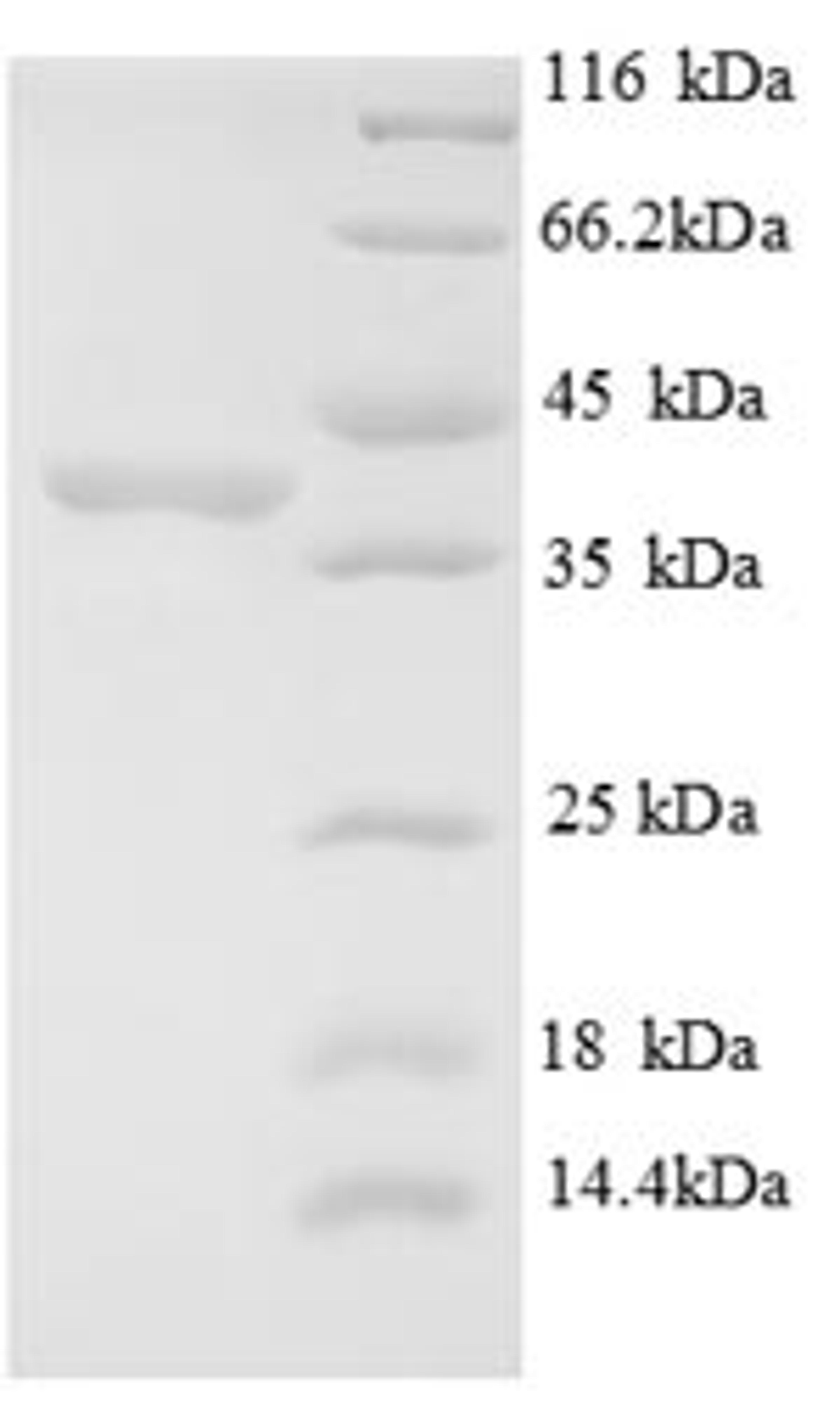 (Tris-Glycine gel) Discontinuous SDS-PAGE (reduced) with 5% enrichment gel and 15% separation gel.