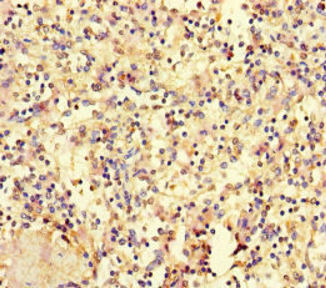 Immunohistochemistry of paraffin-embedded human spleen tissue using CSB-PA010689LA01HU at dilution of 1:100