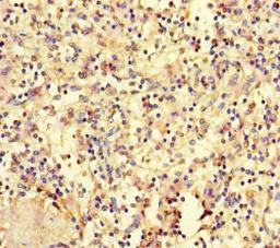 Immunohistochemistry of paraffin-embedded human spleen tissue using CSB-PA010689LA01HU at dilution of 1:100