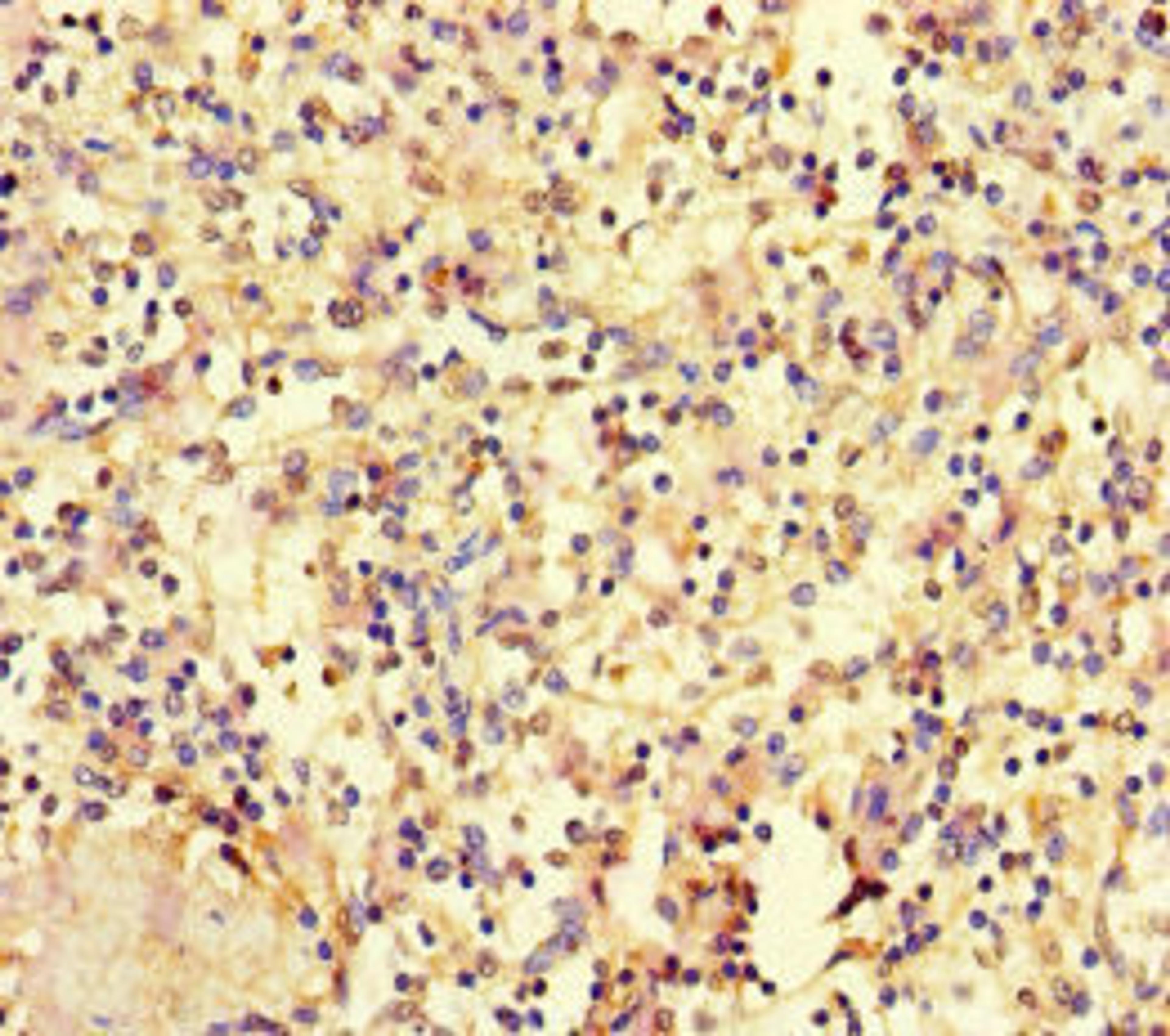 Immunohistochemistry of paraffin-embedded human spleen tissue using CSB-PA010689LA01HU at dilution of 1:100