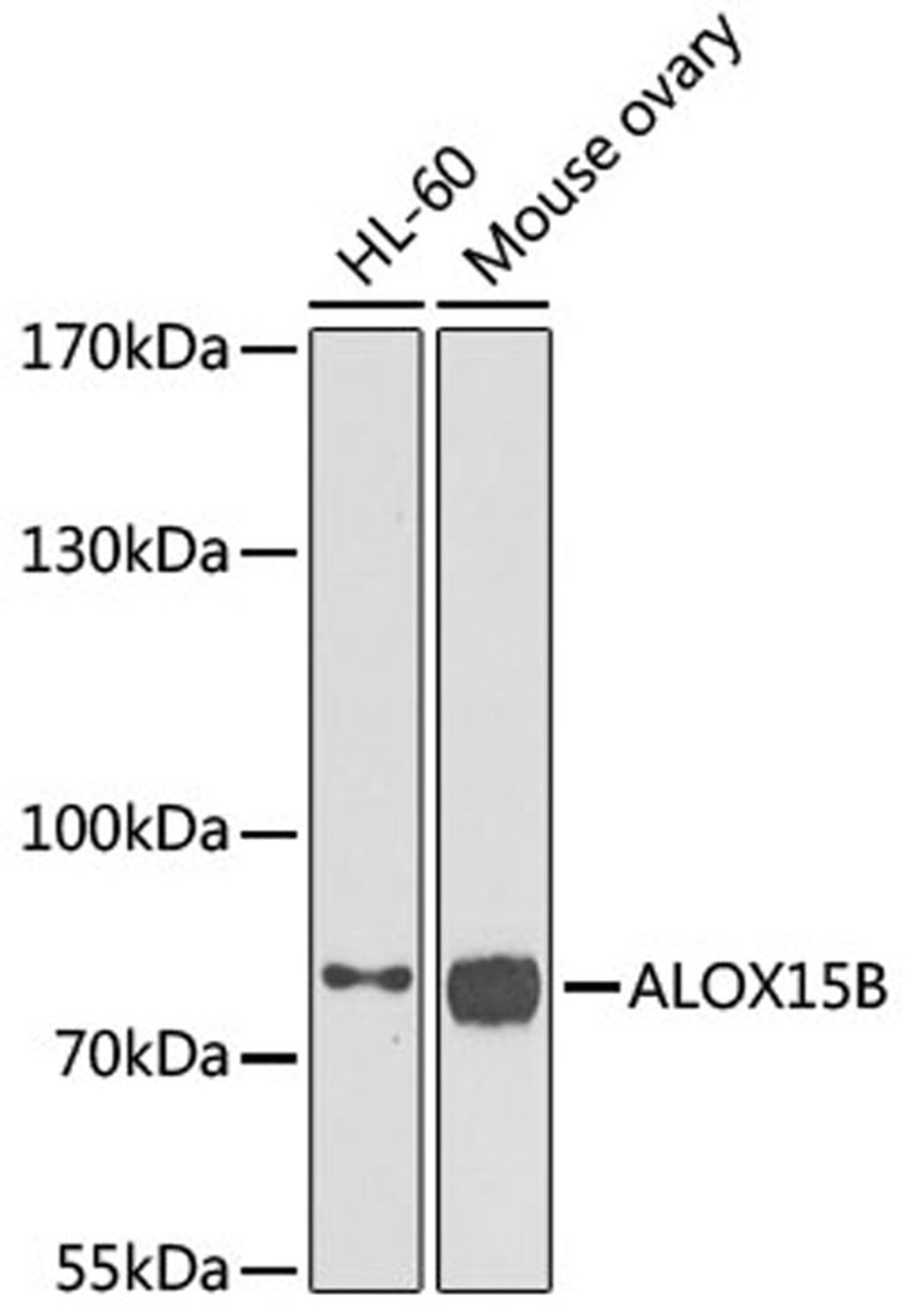 Western blot - ALOX15B antibody (A6865)