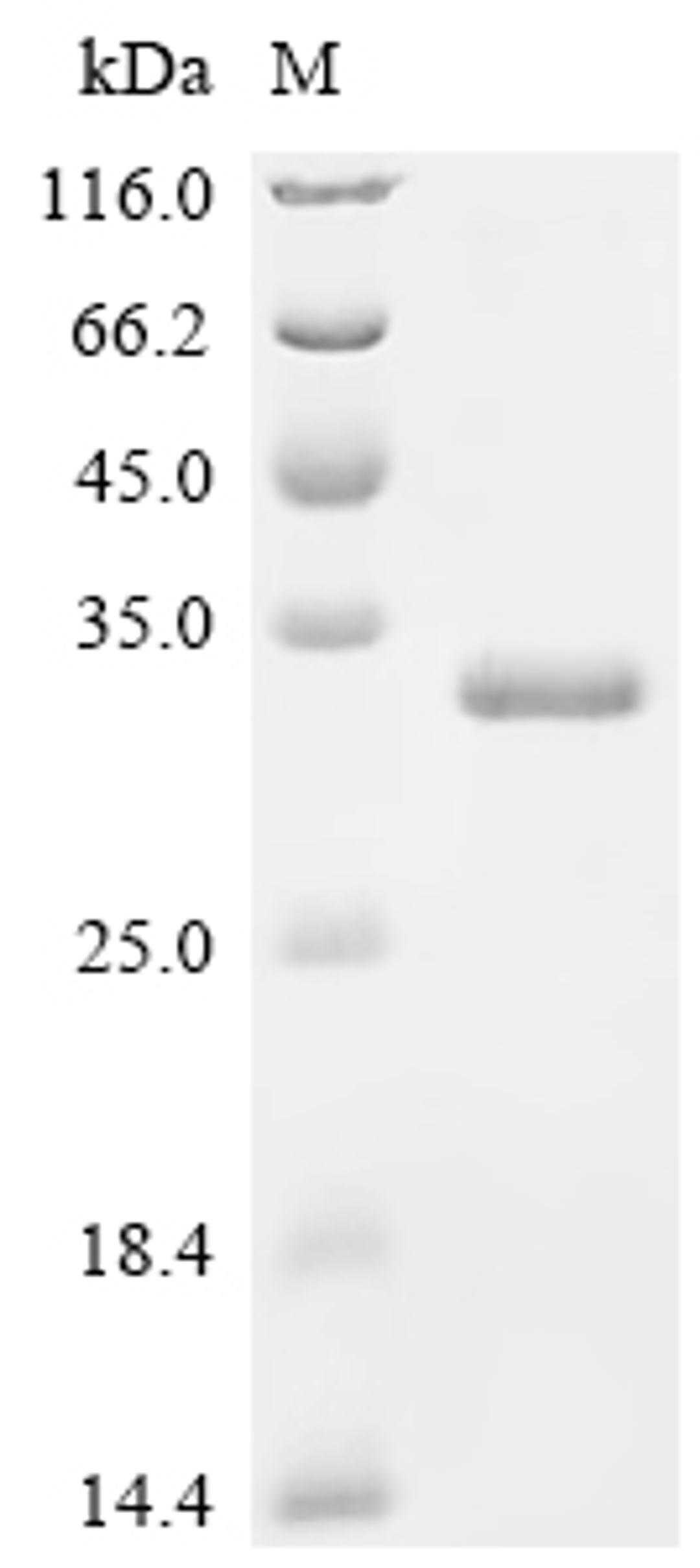(Tris-Glycine gel) Discontinuous SDS-PAGE (reduced) with 5% enrichment gel and 15% separation gel.