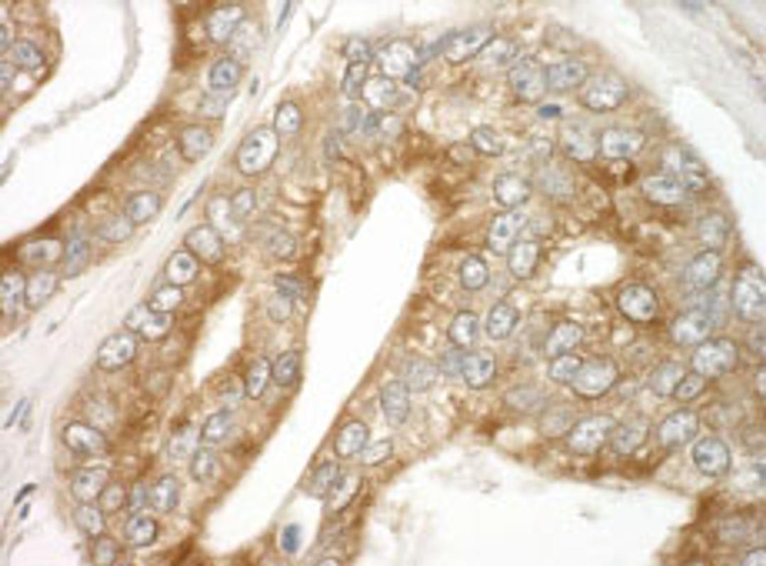 Detection of human EB1 by immunohistochemistry.