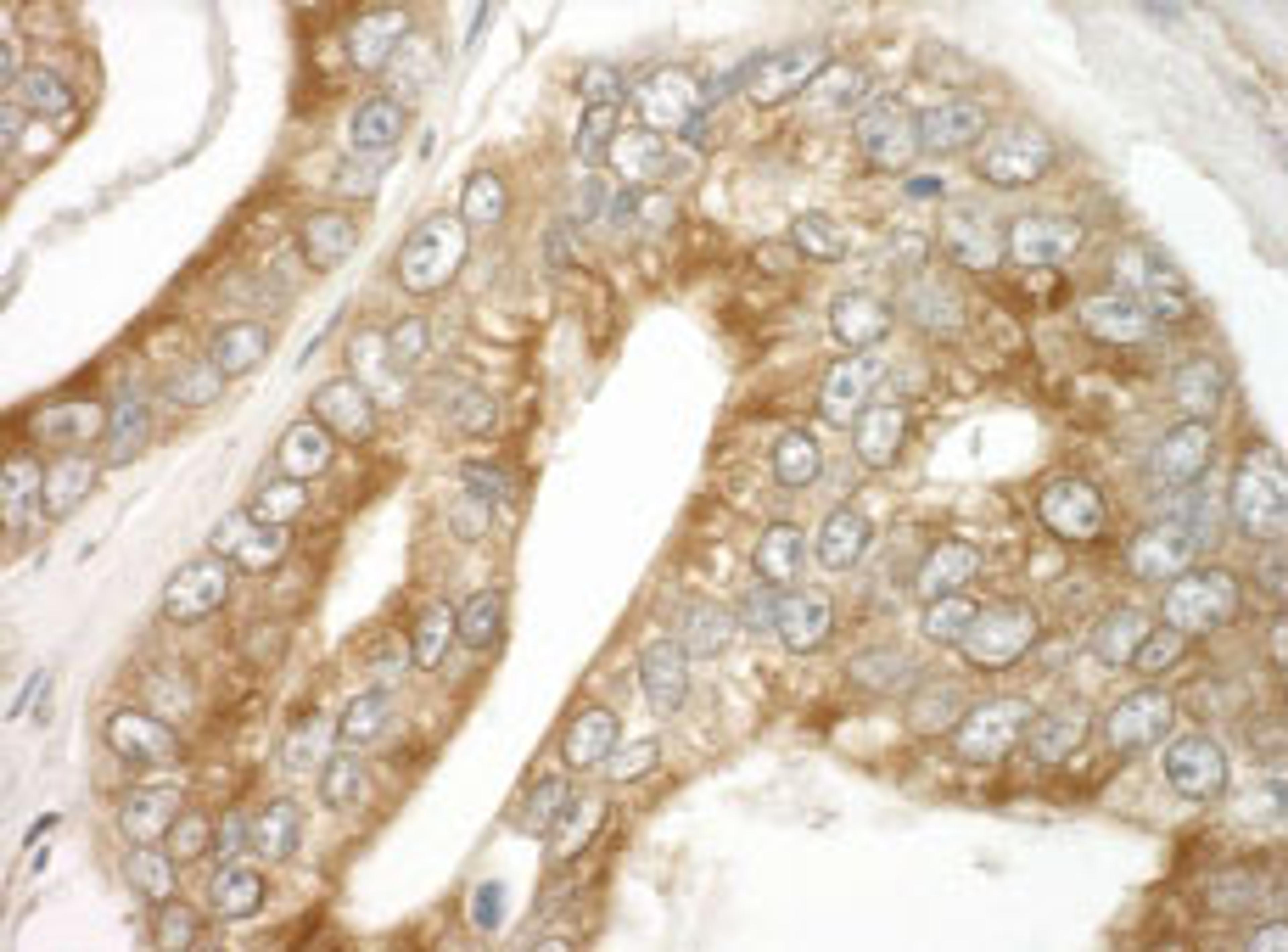 Detection of human EB1 by immunohistochemistry.