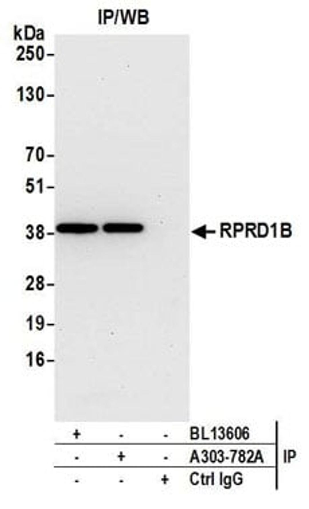 Detection of human RPRD1B by western blot of immunoprecipitates.