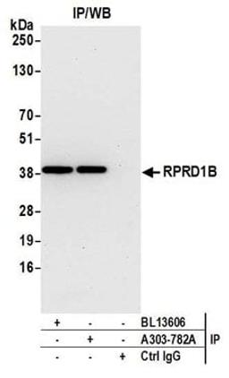 Detection of human RPRD1B by western blot of immunoprecipitates.