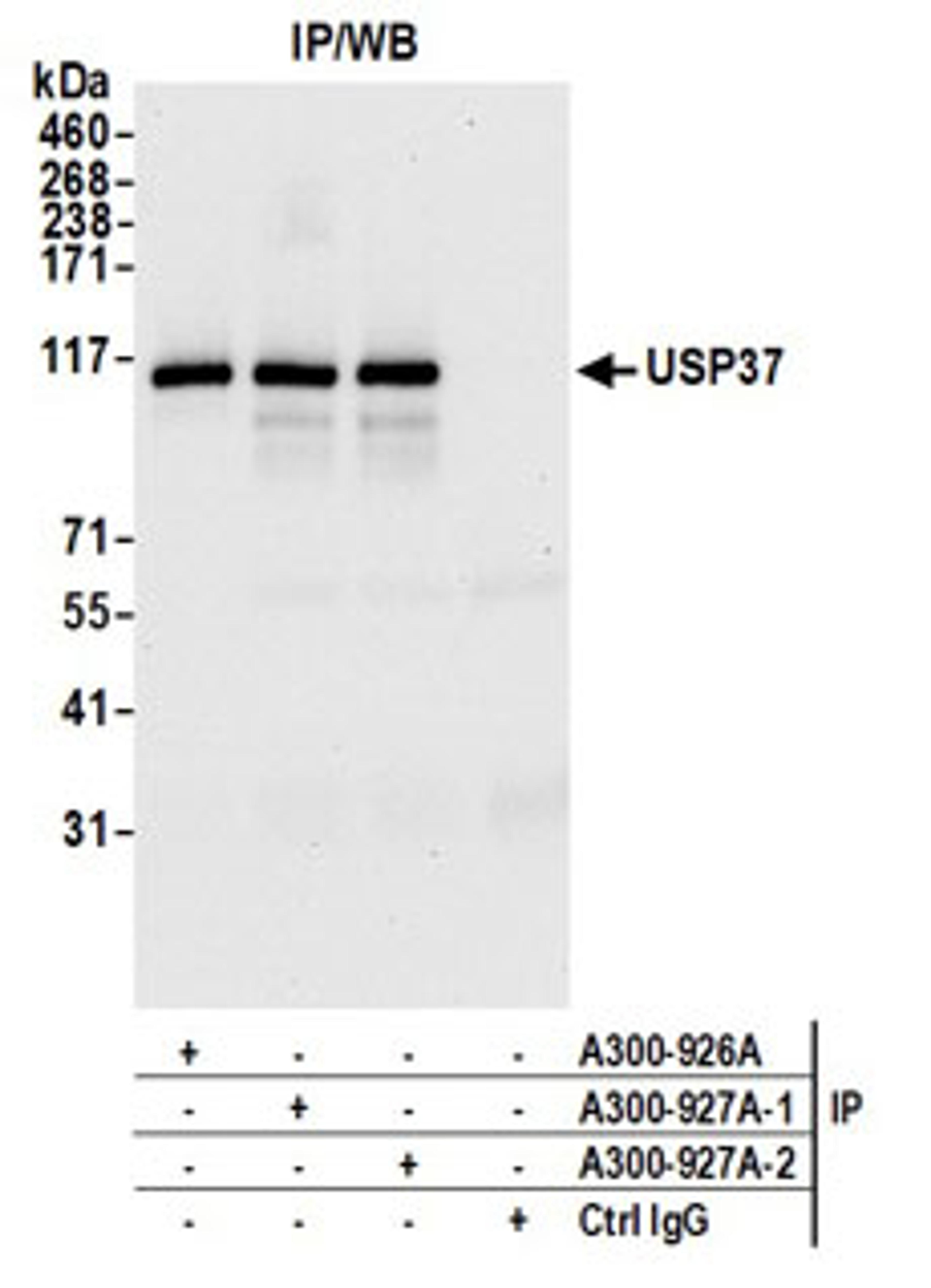 Detection of human USP37 by western blot of immunoprecipitates.