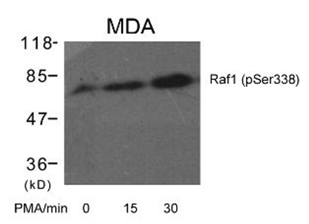 Western blot analysis of lysed extracts from MDA cells untreated or treated with PMA for the indicated times using Raf1 (Phospho-Ser338).