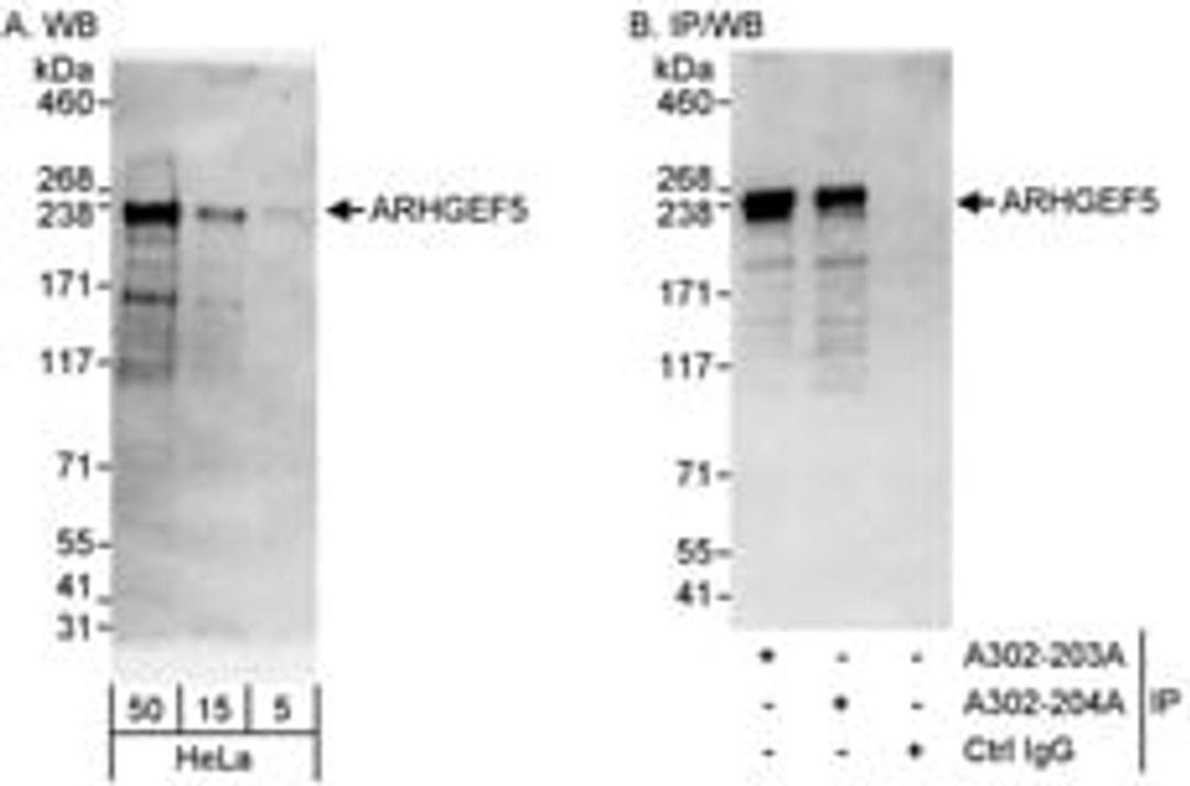 Detection of human ARHGEF5 by western blot and immunoprecipitation.