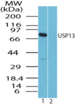 Western Blot: USP13 Antibody [NBP2-24575] - analysis of human spleen lysate in the 1) absence and 2) presence of immunizing peptide using USP13 antibody at 0.25 ug/ml. I goat anti-rabbit Ig HRP secondary antibody and PicoTect ECL substrate solution were used for this test.