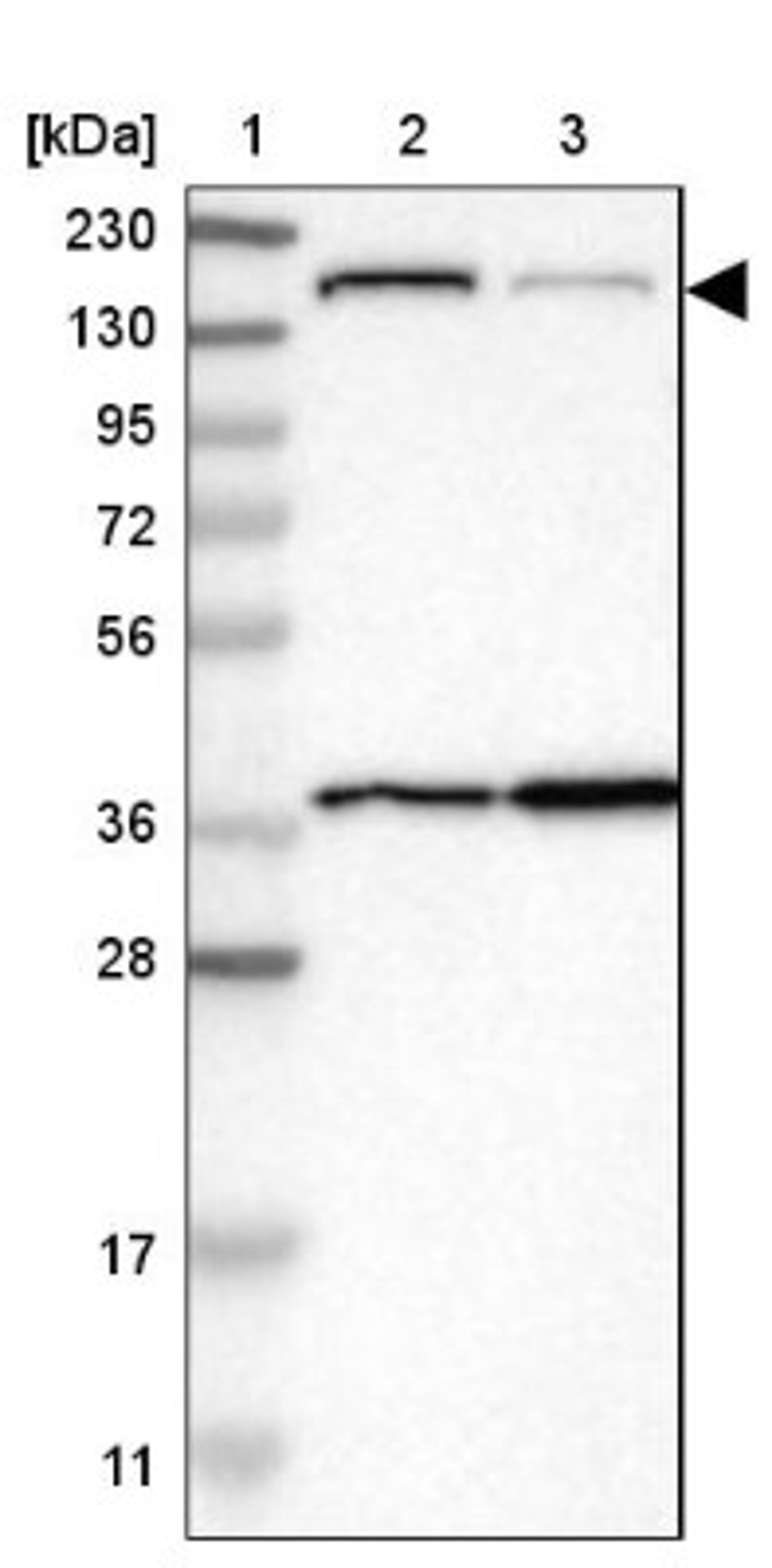 Immunohistochemistry: SAMD9 Antibody [NBP1-91245] - Lane 1: Marker [kDa] 230, 130, 95, 72, 56, 36, 28, 17, 11<br/>Lane 2: Human cell line RT-4<br/>Lane 3: Human cell line U-251MG sp